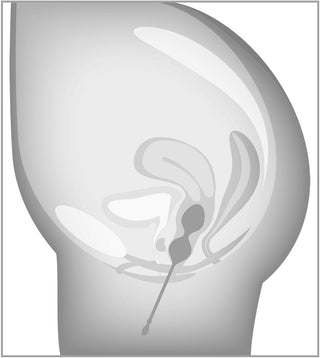 Svartvit Knipkulor Set 3 Delar ELORIN, visas i diagram; har slät sfärisk design, troligen plast eller metall.